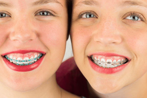 Modern metal braces
